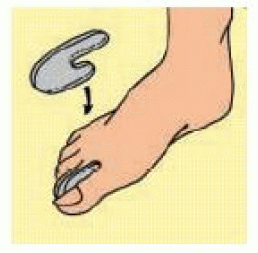 Gel Toe Spreader Distan Dita S