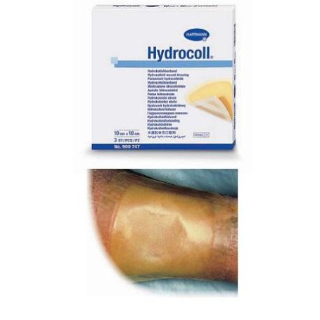 Hydrocoll Medic Ster 10x10 10p